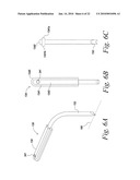 SACROILIAC JOINT FUSION ALIGNMENT GUIDE diagram and image