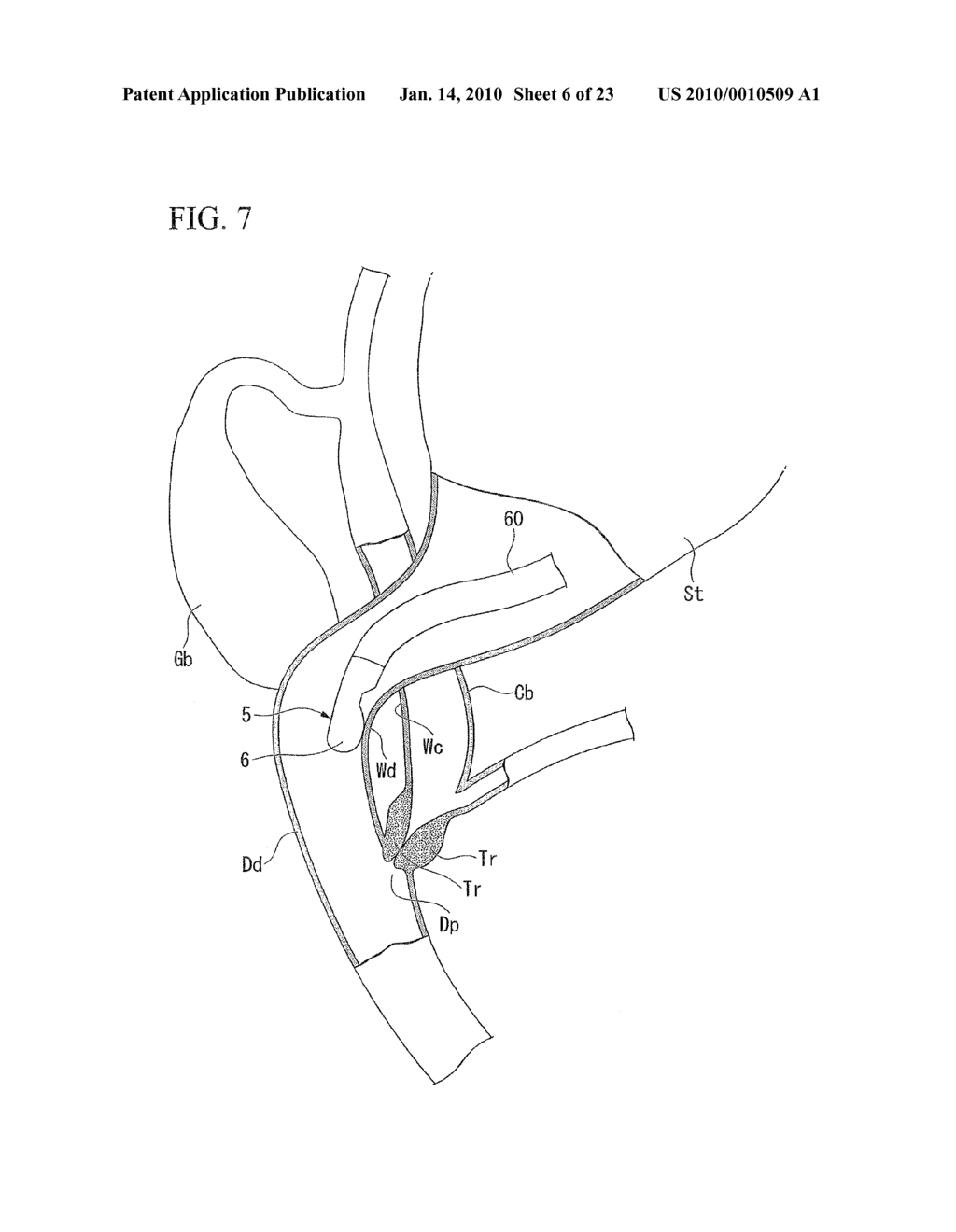 TISSUE FASTENING APPARATUS - diagram, schematic, and image 07