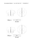 INSERTABLE PROSTHESIS AND PROSTHESIS BOARD FOR ANASTOMOSIS diagram and image