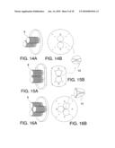 INSERTABLE PROSTHESIS AND PROSTHESIS BOARD FOR ANASTOMOSIS diagram and image