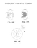 INSERTABLE PROSTHESIS AND PROSTHESIS BOARD FOR ANASTOMOSIS diagram and image