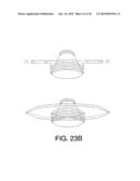 INSERTABLE PROSTHESIS AND PROSTHESIS BOARD FOR ANASTOMOSIS diagram and image