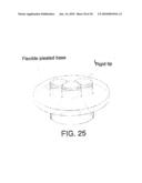 INSERTABLE PROSTHESIS AND PROSTHESIS BOARD FOR ANASTOMOSIS diagram and image