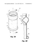 Anastomosis Sheath And Method Of Use diagram and image