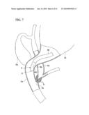 TISSUE FASTENER diagram and image