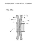 TISSUE FASTENER diagram and image