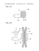 TISSUE FASTENER diagram and image