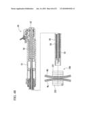 TISSUE FASTENER diagram and image