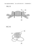 TISSUE FASTENER diagram and image