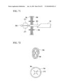 TISSUE FASTENER diagram and image