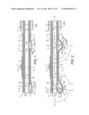 ROTATIONAL ATHERECTOMY DEVICE WITH FLUID INFLATABLE SUPPORT ELEMENTS AND TWO TORQUE TRANSMITTING COILS diagram and image