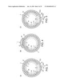 ROTATIONAL ATHERECTOMY DEVICE WITH FLUID INFLATABLE SUPPORT ELEMENTS AND TWO TORQUE TRANSMITTING COILS diagram and image