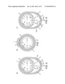 ROTATIONAL ATHERECTOMY DEVICE WITH FLUID INFLATABLE SUPPORT ELEMENTS AND TWO TORQUE TRANSMITTING COILS diagram and image