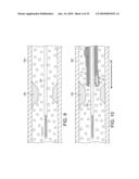 ROTATIONAL ATHERECTOMY DEVICE WITH FLUID INFLATABLE SUPPORT ELEMENTS AND TWO TORQUE TRANSMITTING COILS diagram and image