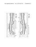 ROTATIONAL ATHERECTOMY DEVICE WITH FLUID INFLATABLE SUPPORT ELEMENTS AND TWO TORQUE TRANSMITTING COILS diagram and image