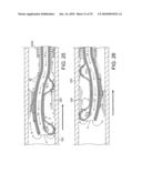 ROTATIONAL ATHERECTOMY DEVICE WITH FLUID INFLATABLE SUPPORT ELEMENTS AND TWO TORQUE TRANSMITTING COILS diagram and image