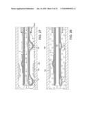 ROTATIONAL ATHERECTOMY DEVICE WITH FLUID INFLATABLE SUPPORT ELEMENTS AND TWO TORQUE TRANSMITTING COILS diagram and image