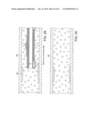 ROTATIONAL ATHERECTOMY DEVICE WITH FLUID INFLATABLE SUPPORT ELEMENTS AND TWO TORQUE TRANSMITTING COILS diagram and image