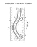 ROTATIONAL ATHERECTOMY DEVICE WITH FLUID INFLATABLE SUPPORT ELEMENTS AND TWO TORQUE TRANSMITTING COILS diagram and image