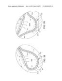 ROTATIONAL ATHERECTOMY DEVICE WITH FLUID INFLATABLE SUPPORT ELEMENTS AND TWO TORQUE TRANSMITTING COILS diagram and image