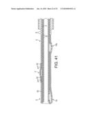 ROTATIONAL ATHERECTOMY DEVICE WITH FLUID INFLATABLE SUPPORT ELEMENTS AND TWO TORQUE TRANSMITTING COILS diagram and image