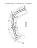 ROTATIONAL ATHERECTOMY DEVICE WITH FLUID INFLATABLE SUPPORT ELEMENTS AND TWO TORQUE TRANSMITTING COILS diagram and image