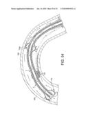 ROTATIONAL ATHERECTOMY DEVICE WITH FLUID INFLATABLE SUPPORT ELEMENTS AND TWO TORQUE TRANSMITTING COILS diagram and image