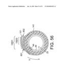 ROTATIONAL ATHERECTOMY DEVICE WITH FLUID INFLATABLE SUPPORT ELEMENTS AND TWO TORQUE TRANSMITTING COILS diagram and image