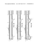 ROTATIONAL ATHERECTOMY DEVICE WITH FLUID INFLATABLE SUPPORT ELEMENTS AND TWO TORQUE TRANSMITTING COILS diagram and image