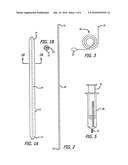 Balloon Dilation for Implantable Prosthesis diagram and image