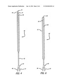 Balloon Dilation for Implantable Prosthesis diagram and image