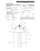 Device For Use In Treatment of Vericose Veins diagram and image