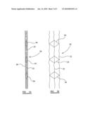 Device For Use In Treatment of Vericose Veins diagram and image