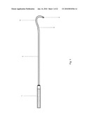 Minimally Invasive Instruments and Methods for the Micro Endoscopic Application of Spine Stabilizers in the Interspinous Space diagram and image