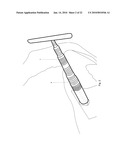 Minimally Invasive Instruments and Methods for the Micro Endoscopic Application of Spine Stabilizers in the Interspinous Space diagram and image