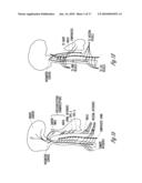 SYSTEM AND METHOD FOR FILTERING NEURAL STIMULATION diagram and image