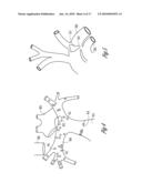 SYSTEM AND METHOD FOR FILTERING NEURAL STIMULATION diagram and image