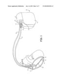 METHODS AND DEVICES FOR RESPONDING TO PREMATURE VENTRICULAR CONTRACTIONS WHILE IN AAI(R) MODE diagram and image