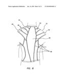 SENSORY MOTOR STIMULATION GARMENT AND METHOD diagram and image