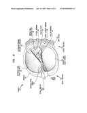 MECHANICAL SEMICIRCULAR CANAL STIMULATOR diagram and image