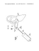 MECHANICAL SEMICIRCULAR CANAL STIMULATOR diagram and image