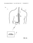 ADJUSTMENT OF POSTURE-RESPONSIVE THERAPY diagram and image