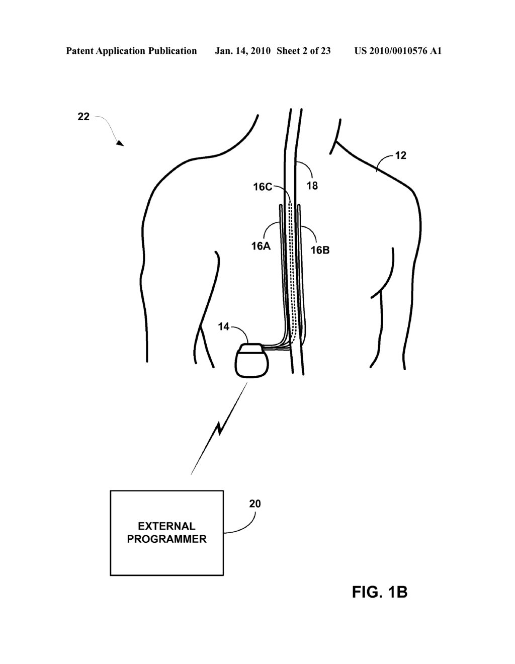 PATIENT INTERACTION WITH POSTURE-RESPONSIVE THERAPY - diagram, schematic, and image 03