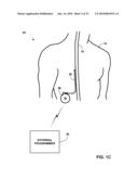 PATIENT INTERACTION WITH POSTURE-RESPONSIVE THERAPY diagram and image