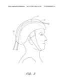 METHOD FOR PROVIDING PHOTOTHERAPY TO THE BRAIN diagram and image