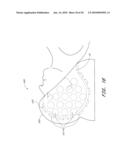 METHOD FOR PROVIDING PHOTOTHERAPY TO THE BRAIN diagram and image