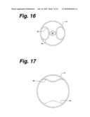 ANASTOMOSIS STENT AND GRAFT APPARATUS AND METHOD diagram and image