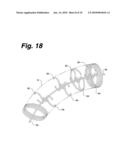 ANASTOMOSIS STENT AND GRAFT APPARATUS AND METHOD diagram and image