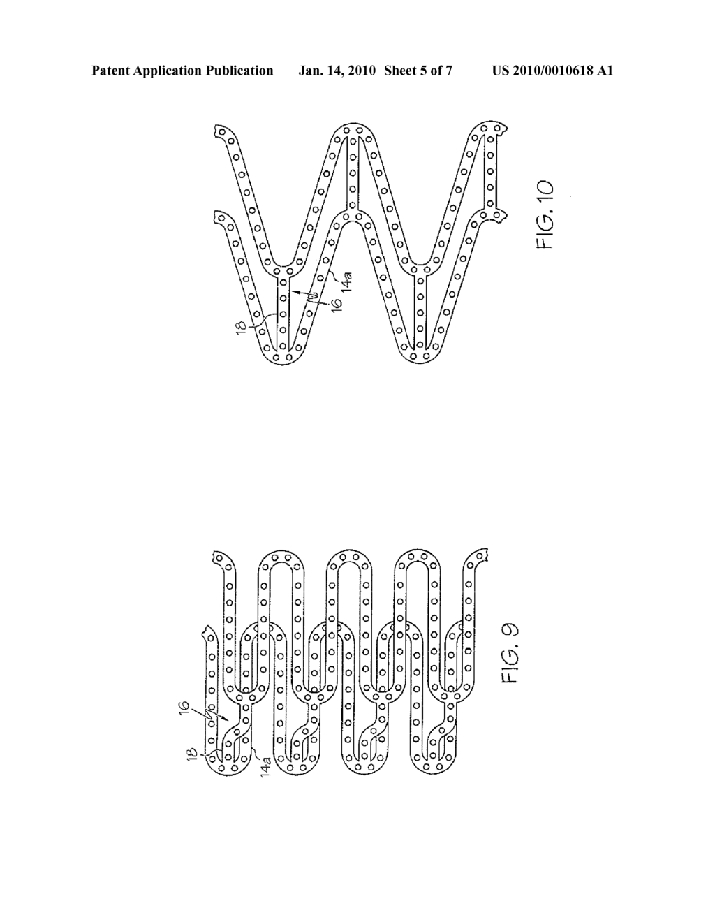 Overlapping Stent - diagram, schematic, and image 06