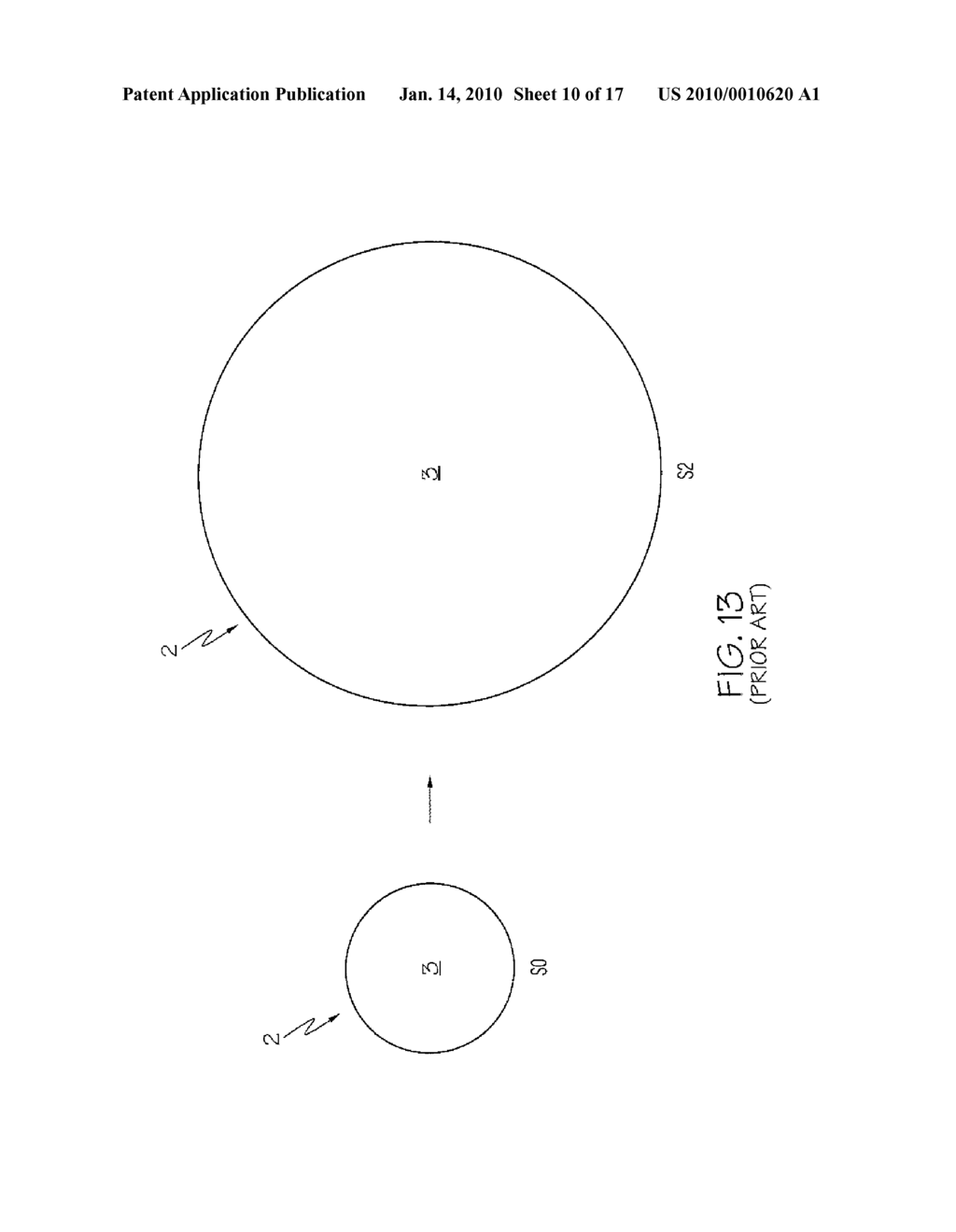 Stent - diagram, schematic, and image 11